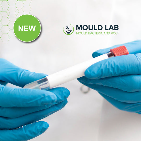 IgG and IgE Antibodies Blood Test (Mycotoxins)
