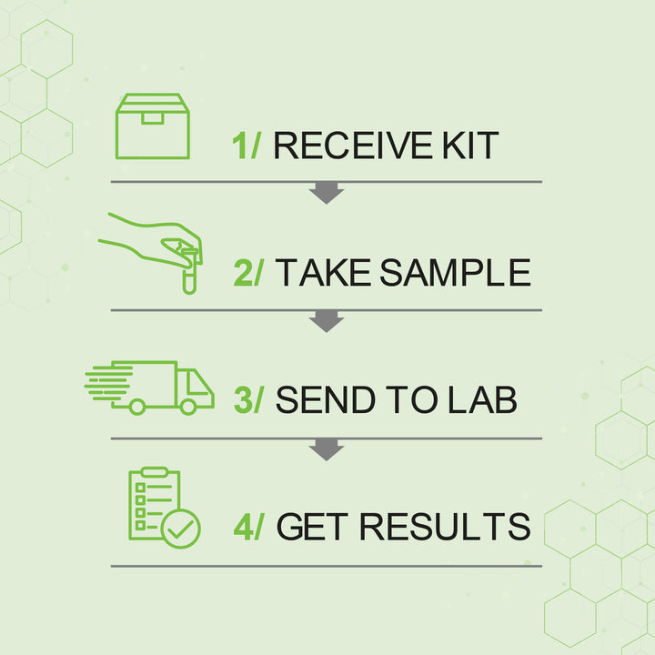 Organic Acids Test - OAT (Urine Sample) – Mould Lab Ltd