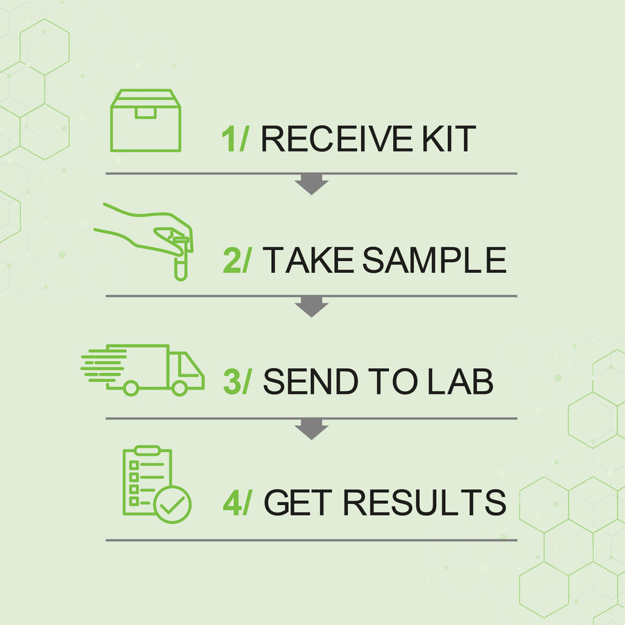 Organic Acids Test - OAT (Urine Sample) – Mould Lab Ltd