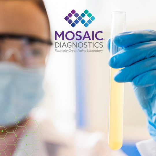 Organic Acids Test  - OAT (Urine Sample)